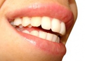 Jakie są sposoby na wybielenie zębów?